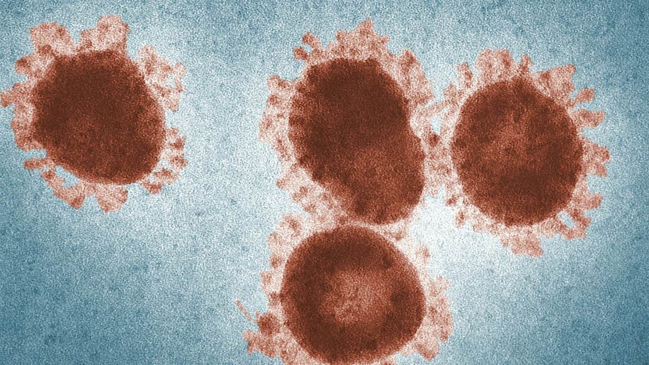 El metapneumovirus humano (HMPV) es un virus respiratorio que ha llamado la atención de expertos y autoridades de salud en todo el mundo.